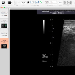 OsiriX MD Pixmeo & NewtonGraphics OsiriX(オザイリクス)は、Mac OS X上で最速の医用画像ブラウジングを実現します。超大容量のDICOMサーバーを導入し、超音波診断装置での診療を動画記録・管理し、長期的な患者様へのサポートに役立てます。